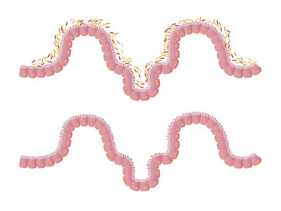 5 Wege gute Darmbakterien beeinflusst die Gesundheit und 17 Zeichen Problem Darm