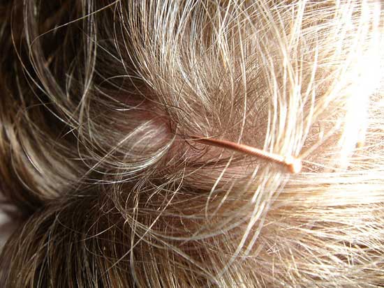 7 Gründe verursachen Klumpen auf der Kopfhaut und 5 natürliche Mittel
