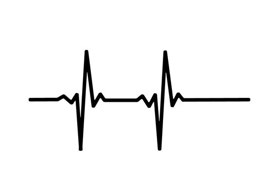 Long QT-Syndrom und Long QT-Syndrom Lebenserwartung