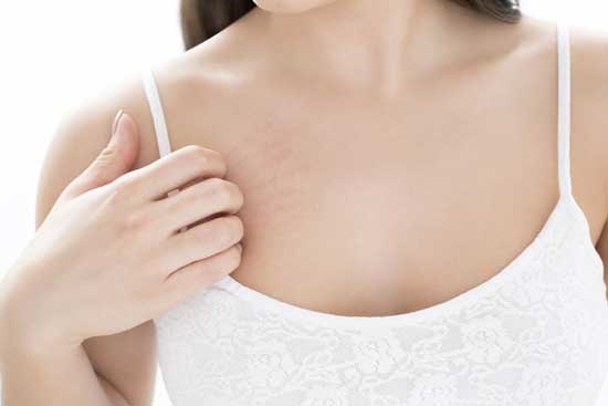 Soor an der Brustwarze Ursachen, 6 Symptome, Behandlung