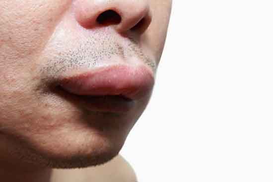 geschwollene Lippen 7 Ursachen und Behandlung
