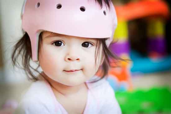 warum ein Baby eine medizinische Helmtherapie benötigt