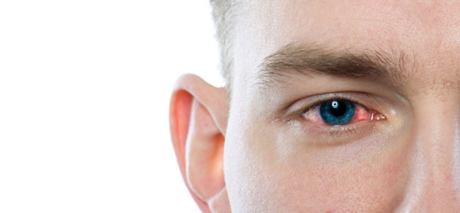 Ursachen und Behandlung von Augenreizungen Allergien und mehr