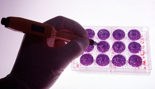 Was ist die Herpes-Virus-Kultur des Läsionstests
