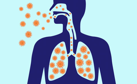 Alles über Lungenentzündung und wie man sie effektiv behandelt