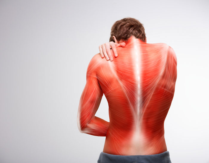 warum meine Muskeln schmerzen häufige Ursachen, Heimbehandlung, wann ein Arzt aufsuchen