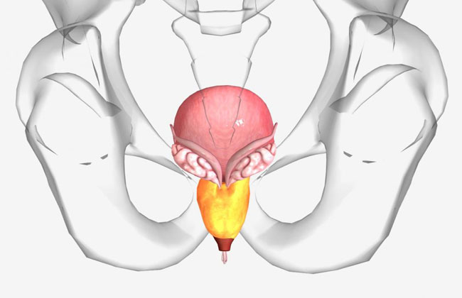 6 Naturheilmittel für die vergrößerte Prostata (BPH)