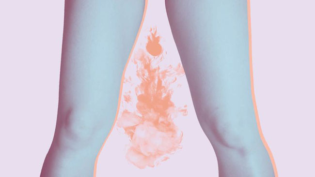 7 verschiedene vaginale Gerüche und warum sie auftreten