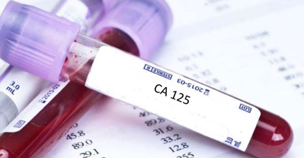 CA-125 Bluttest Zweck, Verfahren und Risiken