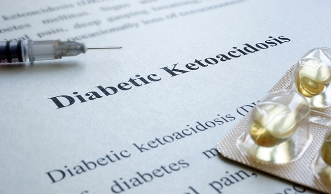 Diabetische Ketoazidose (DKA) Symptome, Ursachen, Behandlung