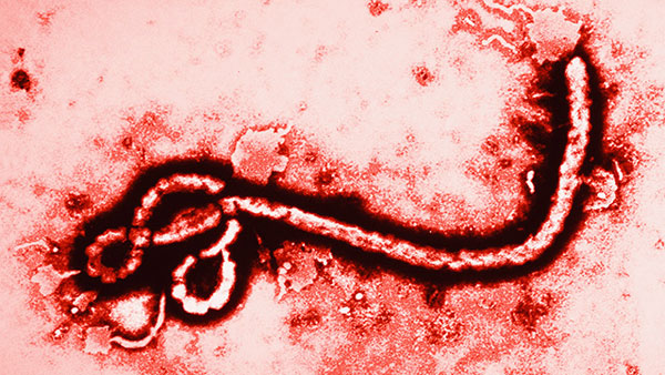 Ebola-Virus und -Krankheit