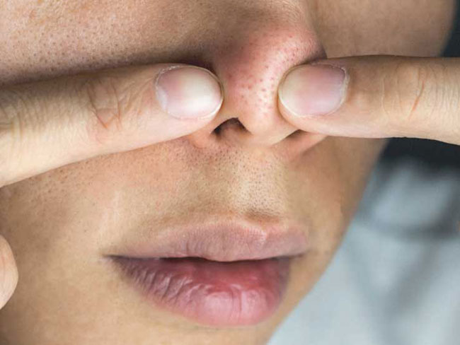Leeres Nasensyndrom Behandlung, Symptome und Tod