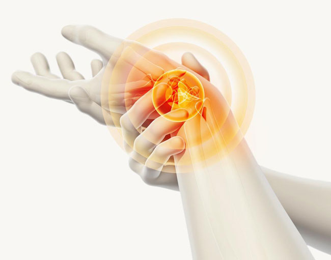 Schmerzen in der Hand 10 mögliche Ursachen