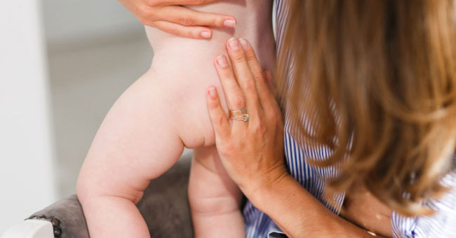 Tipps zur Behandlung von Windelausschlag