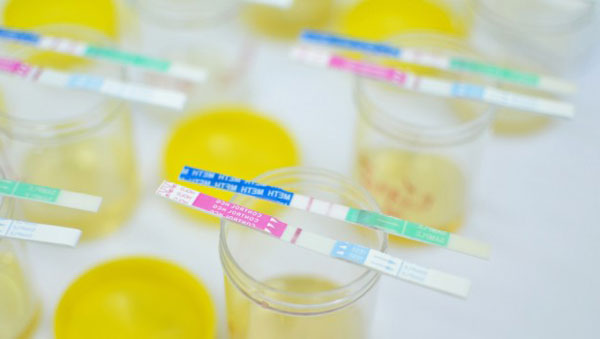 Urin-Drogen-Test Zweck, Arten und Verfahren