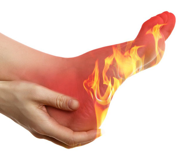 Verbrennung in den Füßen 15 Ursachen, Hausmittel, Diabetes und mehr