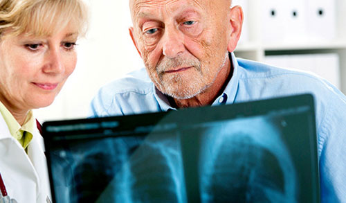 Wie Ärzte Menschen mit COPD behandeln, die eine Lungenentzündung haben